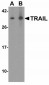 SMARCA4 Antibody