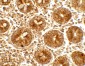 IFIT1 Antibody