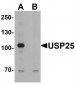 USP25 Antibody
