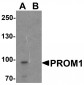 PROM1 Antibody