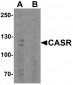 CASR Antibody