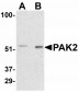 PPARGC1A Antibody