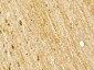 POU2F3 Antibody