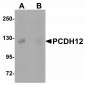 MFN2 Antibody