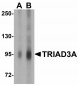 GABARAPL2 Antibody