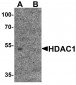 HDAC1 Antibody