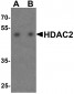 HDAC2 Antibody