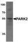 PARK2 Antibody