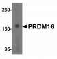 NOX2 Antibody