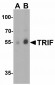 NOX2 Antibody