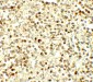 NOX4 Antibody