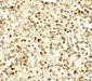 NOX4 Antibody