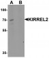 KIRREL2 Antibody