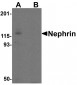 Nephrin Antibody