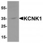 KCNK1 Antibody