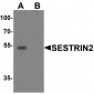SESTRIN2 Antibody