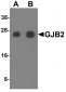 GJB2 Antibody