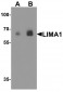 LIMA1 Antibody