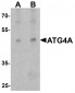 ATG4A Antibody