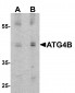 ATG4B Antibody