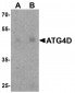 ATG4D Antibody