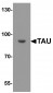 TAU Antibody