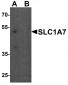 SLC1A7 Antibody