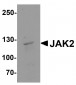 JAK2 Antibody