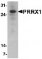 PRRX1 Antibody