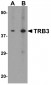 TRB3 Antibody