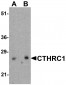 CTHRC1 Antibody