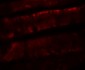 ADORA2B Antibody
