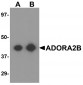 ADORA2B Antibody