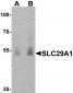 SLC29A1 Antibody