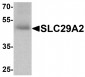 SLC29A2 Antibody