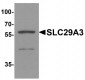 SLC29A3 Antibody