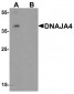 DNAJA4 Antibody
