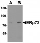 ERp72 Antibody