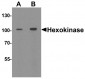 Hexokinase 1 Antibody