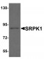 SRPK1 Antibody