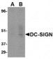 DC-SIGN Antibody [5D7] 
