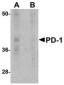 PD-1 Antibody [7A11B1] 