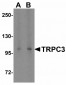 ORAI1 Antibody [6D11A11] 