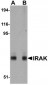 IRAK Antibody [8F1A7] 