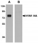 Seasonal H1N1 Hemagglutinin Antibody [7H12F6] 