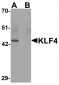 KLF4 Antibody [4E5C3] 
