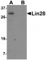 Lin28 Antibody [1G9H9] 