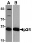 HIV-1 p24 Antibody [8G9] 