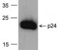 HIV-1 p24 Antibody [8G9] (biotin)