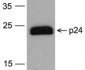 HIV-1 p24 Antibody [7F4] (biotin)